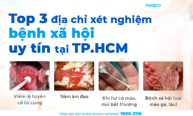 Top 3 địa chỉ xét nghiệm bệnh xã hội uy tín tại TP.HCM