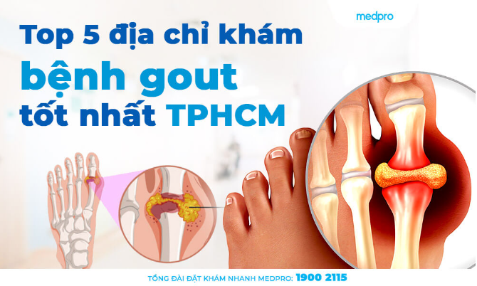 Top 5 địa chỉ khám bệnh Gout (gút) tốt nhất TPHCM