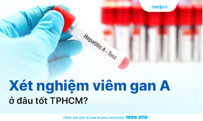Xét nghiệm viêm gan A ở đâu tốt TPHCM?