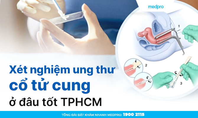 Xét nghiệm ung thư cổ tử cung ở đâu tốt TPHCM?
