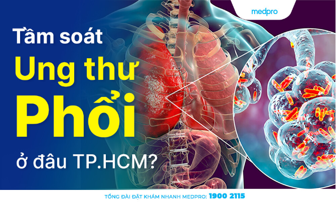Top 3 bệnh viện, phòng khám tầm soát ung thư phổi uy tín TP.HCM?