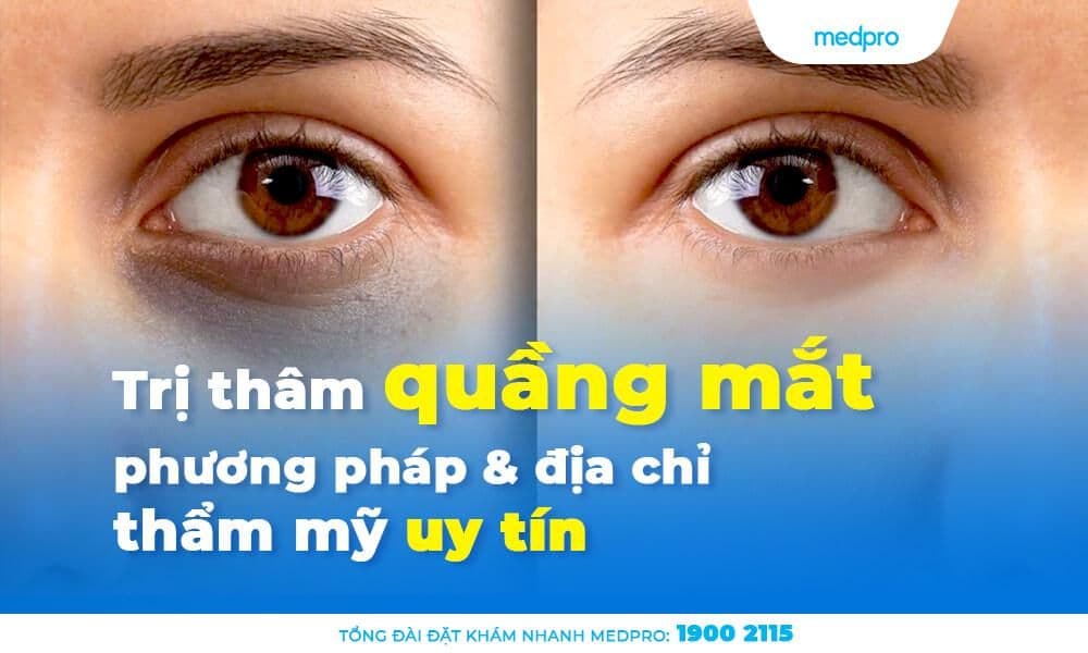 Trị thâm quầng mắt: phương pháp và địa chỉ thẩm mỹ uy tín