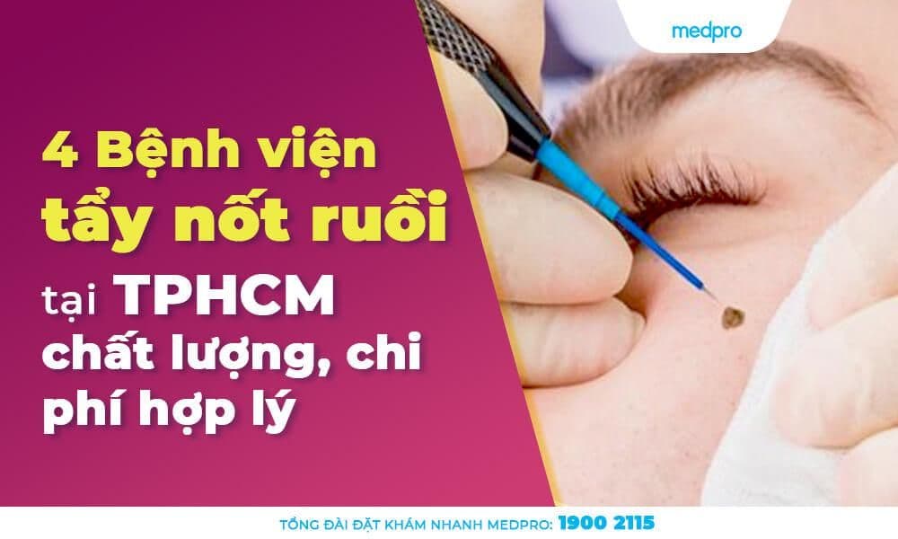 Tẩy nốt ruồi ở đâu tốt? Top 4 bệnh viện đáng tin cậy ở TPHCM