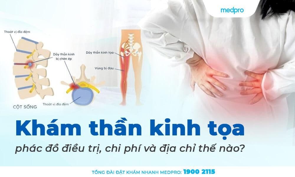 Khám thần kinh tọa là khám gì? Top 4 địa chỉ điều trị uy tín