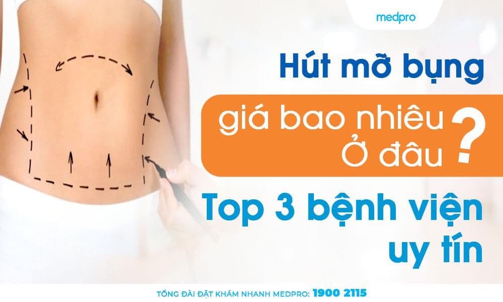 Hút mỡ bụng giá bao nhiêu? Top 3 bệnh viện uy tín